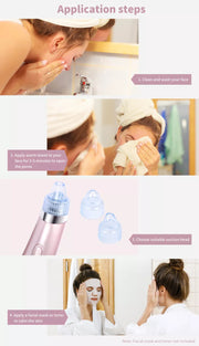 Electric Vacuum Pore Cleaner Blackhead Remover Acne Facial Suction Machine